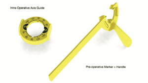 Toric IOL Marking and Alignment System